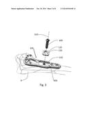 BONE PLATE  WITH  TRANSVERSAL SLOTS FOR RECEIVING A FASTENER diagram and image