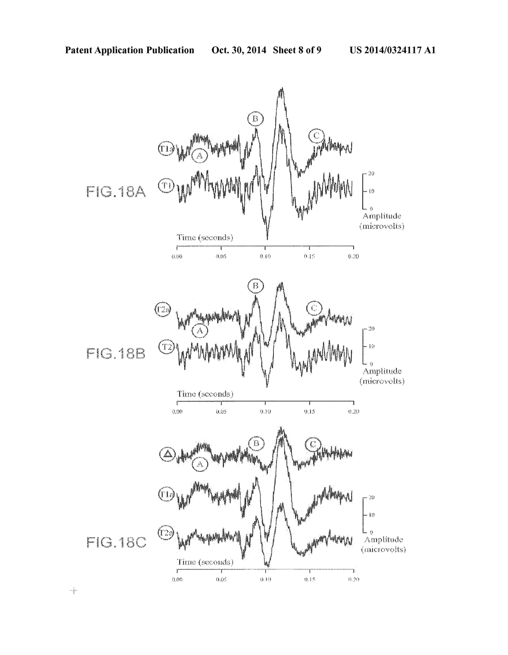 LEAD AND METHODS FOR BRAIN MONITORING AND MODULATION - diagram, schematic, and image 09