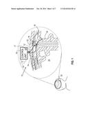 ELECTROOSMOTIC TISSUE TREATMENT diagram and image