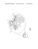 ELECTROOSMOTIC TISSUE TREATMENT diagram and image