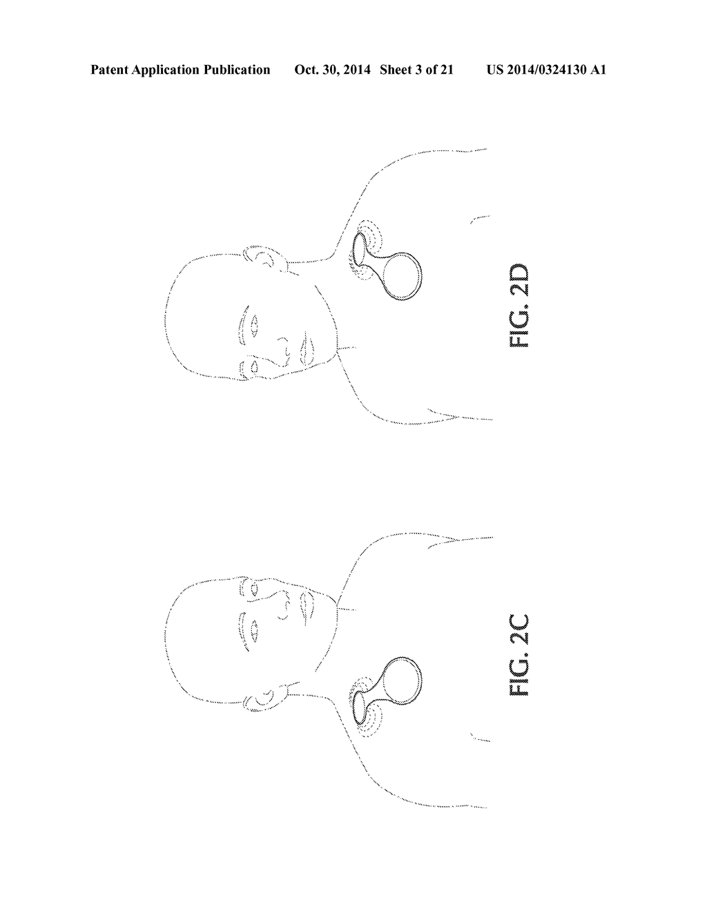 DEVICE AND METHOD FOR SELF-POSITIONING OF A STIMULATION DEVICE TO ACTIVATE     BROWN ADIPOSE TISSUE DEPOT IN SUPRACLAVICULAR FOSSA REGION - diagram, schematic, and image 04