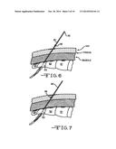 MINIMALLY INVASIVE METHODS FOR IMPLANTING A SACRAL STIMULATION LEAD diagram and image