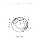 Delivery System With Profiled Sheath Having Balloon-Oriented Position diagram and image