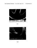 IMPLANTABLE DEVICE WITH PLASMA POLYMER SURFACE diagram and image