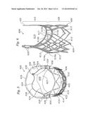 LOW-PROFILE HEART VALVE AND DELIVERY SYSTEM diagram and image