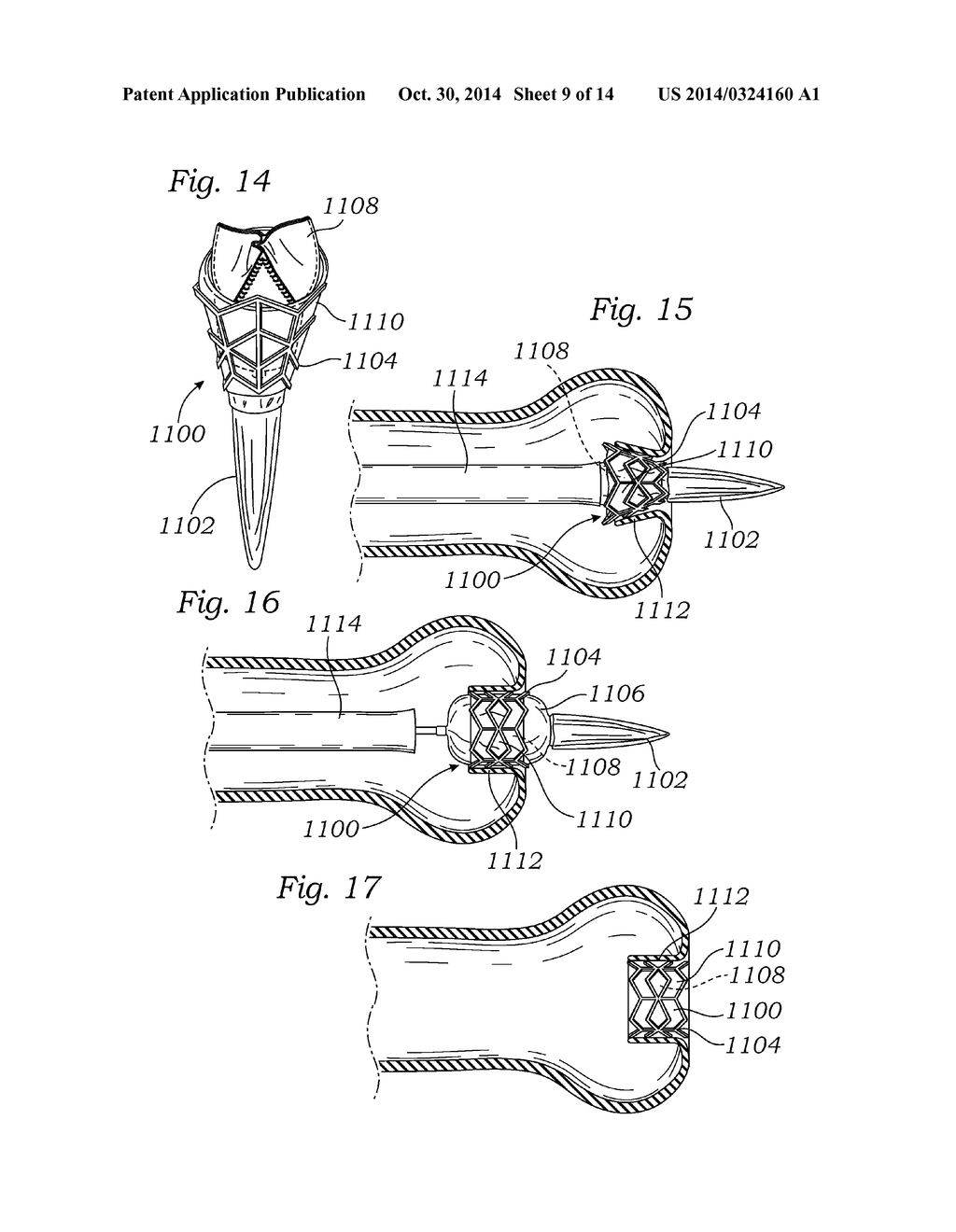 LOW-PROFILE HEART VALVE AND DELIVERY SYSTEM - diagram, schematic, and image 10