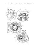 TECHNIQUES FOR PERCUTANEOUS MITRAL VALVE REPLACEMENT AND SEALING diagram and image