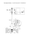 TECHNIQUES FOR PERCUTANEOUS MITRAL VALVE REPLACEMENT AND SEALING diagram and image