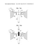 TECHNIQUES FOR PERCUTANEOUS MITRAL VALVE REPLACEMENT AND SEALING diagram and image