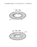 TECHNIQUES FOR PERCUTANEOUS MITRAL VALVE REPLACEMENT AND SEALING diagram and image