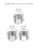 TECHNIQUES FOR PERCUTANEOUS MITRAL VALVE REPLACEMENT AND SEALING diagram and image