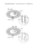 TECHNIQUES FOR PERCUTANEOUS MITRAL VALVE REPLACEMENT AND SEALING diagram and image