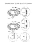 TECHNIQUES FOR PERCUTANEOUS MITRAL VALVE REPLACEMENT AND SEALING diagram and image