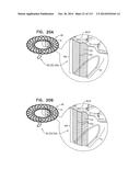 TECHNIQUES FOR PERCUTANEOUS MITRAL VALVE REPLACEMENT AND SEALING diagram and image