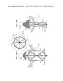 TECHNIQUES FOR PERCUTANEOUS MITRAL VALVE REPLACEMENT AND SEALING diagram and image