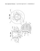 TECHNIQUES FOR PERCUTANEOUS MITRAL VALVE REPLACEMENT AND SEALING diagram and image