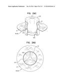 TECHNIQUES FOR PERCUTANEOUS MITRAL VALVE REPLACEMENT AND SEALING diagram and image