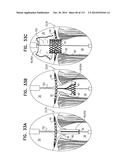 TECHNIQUES FOR PERCUTANEOUS MITRAL VALVE REPLACEMENT AND SEALING diagram and image