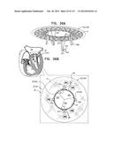 TECHNIQUES FOR PERCUTANEOUS MITRAL VALVE REPLACEMENT AND SEALING diagram and image