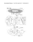 TECHNIQUES FOR PERCUTANEOUS MITRAL VALVE REPLACEMENT AND SEALING diagram and image