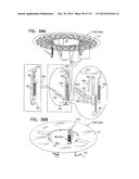 TECHNIQUES FOR PERCUTANEOUS MITRAL VALVE REPLACEMENT AND SEALING diagram and image