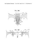 TECHNIQUES FOR PERCUTANEOUS MITRAL VALVE REPLACEMENT AND SEALING diagram and image