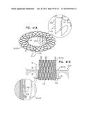 TECHNIQUES FOR PERCUTANEOUS MITRAL VALVE REPLACEMENT AND SEALING diagram and image