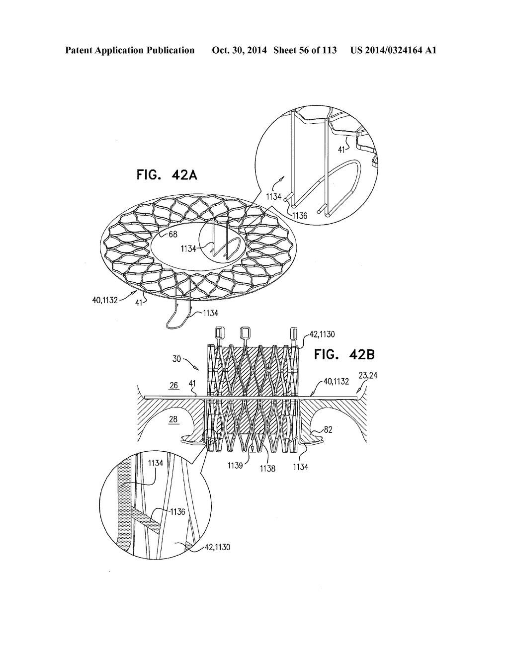 TECHNIQUES FOR PERCUTANEOUS MITRAL VALVE REPLACEMENT AND SEALING - diagram, schematic, and image 57