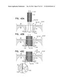 TECHNIQUES FOR PERCUTANEOUS MITRAL VALVE REPLACEMENT AND SEALING diagram and image