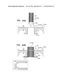 TECHNIQUES FOR PERCUTANEOUS MITRAL VALVE REPLACEMENT AND SEALING diagram and image