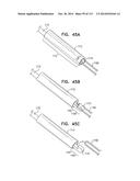 TECHNIQUES FOR PERCUTANEOUS MITRAL VALVE REPLACEMENT AND SEALING diagram and image