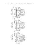 TECHNIQUES FOR PERCUTANEOUS MITRAL VALVE REPLACEMENT AND SEALING diagram and image