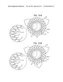 TECHNIQUES FOR PERCUTANEOUS MITRAL VALVE REPLACEMENT AND SEALING diagram and image