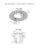 TECHNIQUES FOR PERCUTANEOUS MITRAL VALVE REPLACEMENT AND SEALING diagram and image