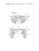 TECHNIQUES FOR PERCUTANEOUS MITRAL VALVE REPLACEMENT AND SEALING diagram and image