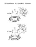 TECHNIQUES FOR PERCUTANEOUS MITRAL VALVE REPLACEMENT AND SEALING diagram and image