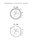 TECHNIQUES FOR PERCUTANEOUS MITRAL VALVE REPLACEMENT AND SEALING diagram and image