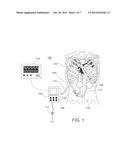 Controlling Implanted Blood Pumps diagram and image