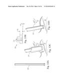 MULTI-COMPONENT NON-BIODEGRADABLE IMPLANT, A METHOD OF MAKING AND A METHOD     OF IMPLANTATION diagram and image