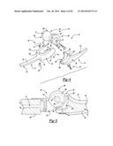 ELBOW PROSTHESIS diagram and image