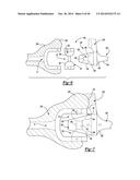 ELBOW PROSTHESIS diagram and image