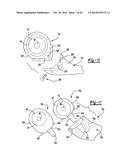 ELBOW PROSTHESIS diagram and image