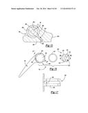 ELBOW PROSTHESIS diagram and image