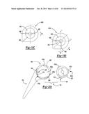 ELBOW PROSTHESIS diagram and image