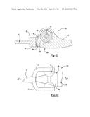 ELBOW PROSTHESIS diagram and image