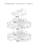 ELBOW PROSTHESIS diagram and image