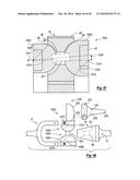 ELBOW PROSTHESIS diagram and image