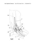 ELBOW PROSTHESIS diagram and image