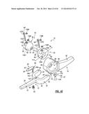 ELBOW PROSTHESIS diagram and image