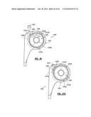 ELBOW PROSTHESIS diagram and image